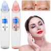 NCRD Blackhead Remover, Pore Vacuum Cleaner, Whitehead Remover Tool with with 4 Replacement Head and 3 Level Suction (Color : White) view 3