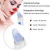 NCRD Blackhead Remover, Pore Vacuum Cleaner, Whitehead Remover Tool with with 4 Replacement Head and 3 Level Suction (Color : White) view 4