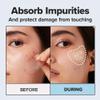 I DEW CARE Hydrocolloid Acne Pimple Patch - Timeout Blemish Chin & Cheeks | Korean zit Dark Spot Patches for face and skin, Pus absorbing with Tea Tree Leaf Oil, 9 Count view 4