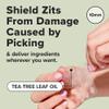I DEW CARE Hydrocolloid Acne Pimple Patch - Timeout Blemish Original | Korean Zit Dark Spot Patches for Face and Skin, Pus absorbing with Tea Tree Oil, Trouble Treatment, 36 Count view 2