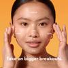 Hero Cosmetics Mighty Patch Face Patch - XL Hydrocolloid Face Mask for Acne, 5 Large Pimple Patches for Zit Breakouts on Nose, Chin, Forehead & Cheeks (1 Count) view 2