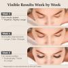 WM WESTERN MIRACLE Eyelash Serum for Longer, Thicker Lashes - Enhances Natural Lashes, Extensions & Brows - 1 Pack view 4