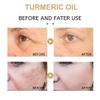 2Pack Turmeric Corrector Serum, Natural Turmeric Repair Face Serum for Face, Hydrate and Dry Skin view 2