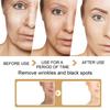 2 Pack Turmeric Dark Spot Corrector Serum Oil, Repair Face Serum, Natural Turmerics Bright Skin Care Moisturizing Repair Serums, Turmeric Oil for Face Dark Spots(30ml) view 4