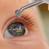 1pc Tweezers Eyelid Expressor Forceps Meibomian Gland Forceps Eyelid Compressor Meibomian Expressor Gland view 3
