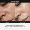 Medicube Age-R ATS Air Shot - Microneedling Pore Tightening Skin Care Device for Enhanced Absorption, Pore Refinement, and Smoother Skin Texture - Exfoliation, Skin Rejuvenation - Korean Skin Care view 4