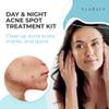 Ayadara Day & Night Cystic Acne Spot Care for Skin, Hormonal Acne Support for Daytime & Overnight, Cystic Acne Skin Balancing Formula for Face, Acne Cream with Tea Tree & Bentonite Clay, 90 Day Supply view 2