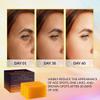 VALITIC Kojic Acid Dark Spot Remover Soap Bars with Vitamin C, Retinol, Collagen, Turmeric - Original Japanese Complex Infused with Hyaluronic Acid, Vitamin E, Shea Butter, Castile Olive Oil (3 Pack) view 2