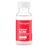 Neutrogena Stubborn Acne Spot Drying Lotion, Fragrance-Free Sulfur Acne Treatment Clears Acne By Drying Up & Shrinking Pimples, Paraben- & Oil-Free, 10% Sulfur & 4% Niacinamide, 1.0 fl. oz view 2