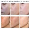 2 Pcs Whitening Freckle Cream, Acne Scar Removal Treatment Cream, Pigmentation Removal Cream for Face, Moisturizing Removes Facial Melasma Dark Spots Wrinkles Blemishes (whitening freckle cream) view 3