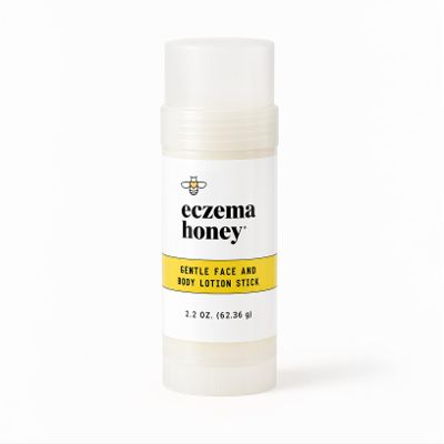 ECZEMA HONEY Gentle Face & Body Lotion Stick - Moisturizing Colloidal Oatmeal Hand Cream for Extremely Dry Skin - Eczema Lotion Helps Psoriasis, Dermatitis & More (2.2 Oz)