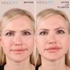 Mesolyft Neck & Lip Plumper Combo with Roller to Instantly Plump Lips & Neck - Neck Serum Improves the Neck Skin - Plumping Serum to Moisturize Your Lips and Neck view 4
