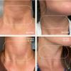 Dermaclara Neck Wrinkle Patches - Silicone Neck Patches for Wrinkles, Anti Aging and Tightening Overnight Skin Treatment for Women and Men, Anti-Wrinkle Pads, Reusable Up to 30 Times - 1 Patch view 3