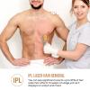 CGK NEW Upgraded IPL Hair Removal with Cooling System for Women & Men, Painless Laser Hair Removal for Armpits Back Legs Arms Face Bikini Line at Home view 3