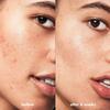 e.l.f. SKIN Blemish Breakthrough Blemish Control Basics Kit, Travel-Size Acne Skincare Routine, Cleanser, Serum & Moisturizer, Vegan & Cruelty-Free view 4