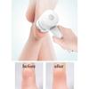 HMTE Electric Callus Remover - Portable Dead Skin Foot File, USB Charging Foot Grinder with Vacum Cleaner, Dual Speed Foot Grinder Cordless for Cracked Heels,White (White) view 4