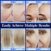 High Frequency Facial Wand - Uaike Portable Handheld Blue High Frequency Skin Facial Machine at Home - Skin Face Wand Device with 4 Different Blue Glass Tubes (Blue) view 4