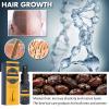 Hair Growth Castor Oil Spray, Organic Castor Hair Growth Serum Nourishing Ginger Spray for Eyelashes and Eyebrows Hair Growth, Hair Thickness Oil for Women and Men view 4