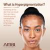 Ambi Even & Clear Fade Cream, Hydroquinone-free, Hyperpigmentation Treatment, Dark Spot Corrector, Results In As Little As 4 Weeks, Niacinamide, Aloe Vera, Vitamin C, 1 Fl Oz view 3