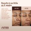 Ambi Even & Clear Fade Cream, Hydroquinone-free, Hyperpigmentation Treatment, Dark Spot Corrector, Results In As Little As 4 Weeks, Niacinamide, Aloe Vera, Vitamin C, 1 Fl Oz view 4