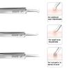 Professional Facial Blackhead Remover Tweezers,3Pcs Precision Pimple Popper Tool Kit for Whitehead Ance Blemishs Comedones Stainless Steel Makeup Tool - Glossy view 3