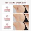 Laser Hair Removal with Cooling, at-Home IPL Hair Removal for Women Men, Upgraded to 999,900 Flashes Permanent Hair Removal Device on Facial Legs Arms Bikini Line view 2