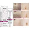 Scars Removal Cream, Mango Remove Pregnancy Scars Cream Stretches Marks Treatment Maternity Repair Firming Skin view 3