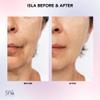 Spa Sciences ISLA Ice + Heat Contouring Roller (Face, Neck, and Dcolletage)  Including Steel + Bonus Genuine Rose Quartz Globes view 3