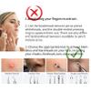 22 Pcs Pimple Popper Tool, Blackhead Remover Acne and Zit Comedone Extractor Kit view 2