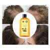Ginaday Instant Ginger Hair Regrowth Shampoo, Ginger Anti-Fall Shampoo for Hair Growth, Anti-Hair Loss Hair Shampoo (1Pcs 9.47FL.oz/280ML) view 4