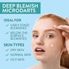 VILVIN Microdart Acne Patch - Zit Patches for Face - 27 ea - Fast Acting Blemish Cystic acne patches - Hyaluronic Acid, Tea Tree - Micropoint Pimple Patch view 2