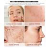 Healifty Manual Face Cleansing Brush Soft Bristles Deep Cleaning Facial Brush Set for Women's Skin Care view 4