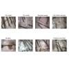 100X Scalp Health Skin Analyzer, 1MP Digital Microscope for Smart Analysis, Professional Beauty Tool for Home Salon Use, Scalp Detector view 3