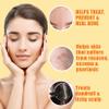 10% Sulfur Soap Cleansing Bar for Face & Body  All Natural Sulfur Facial Cleanser for Acne, Oily Skin  Skincare Blend of Lemongrass, Tea Tree Essential Oil, Vitamin E, Coconut Milk  Sulfur Soap Bar view 2