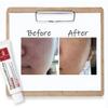  ARZTIN Regenerative Schild Cream, Great for Calming, Anti-aging, Non-sticky Cream view 2