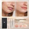 SGNEKOO Milia Remover Whitehead Extractor, Blackhead Tweezers with Angled Loop & Acne Needle Rose Gold in Case,Professional Facial Tool Kit view 3