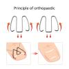 Toe Nail Correction Wire,Toe Nail Correction Tool, Wire Straightening Pedicure Treatment Foot Care Tool for Nail Recover Foot Care, Bunion Corrector for Men and Women view 3