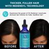 RemeVerse Replenishing Hair Serum - Nourish Scalp & Fortifies Follicle Strand with Redensyl, Infused with Biotin for Thinning Hair and Collagen for Dry Scalp, Densifying Unscented Hair Serum 4 Fl Oz view 3