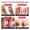 FOOT CURE Foot Soak with Epsom Salts  All-Natural Blend for Relaxing Foot Care  Softens Calluses & Refreshes Feet  Invigorating Scent, Spa Pedicure  16 oz (Pack of 1) view 4