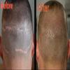 HD-M - SMP Scalp pigment - 1 Oz view 3
