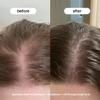 BONDIBOOST Procapil Scalp Treatment [4.23 fl oz], Daily Leave In Treatment for Thinning Hair + Anchor Hair, Scalp Serum for Thicker Hair with Procapil, Rosemary & Biotinoyl Tripeptide-1, Sulfate-Free view 3