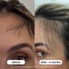 BONDIBOOST Procapil Scalp Treatment [4.23 fl oz], Daily Leave In Treatment for Thinning Hair + Anchor Hair, Scalp Serum for Thicker Hair with Procapil, Rosemary & Biotinoyl Tripeptide-1, Sulfate-Free view 4