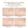 AKARY Acne Scar Removal Cream, Herbal Fade Scar Marks Burns Repair Cream, Stretch Marks Face Skin Cream Shrink Pores Gel, Old and New Scars Skin Repair Gel Skin Care view 4