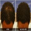 Dr. Yates MD Keratin Fiber Hair Enhancer (Medium Brown) view 4