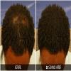 Dr. Yates MD Keratin Fiber Hair Enhancer (Black) view 4