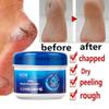 Foot Cream Anti-Cracking Moisturizing Foot and Hand Cream Beauty, Foot Cream For Dry Cracked Heels, Cracked Heel Treatment Repair, Foot Lotion Soften Rough & Calloused Feet Hand (3Pcs) view 2