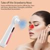 Feiyx Blackhead Remover Pore Vacuum,USB Rechargeable Blackhead Extractor,Electric Facial Pore Cleaner Acne Comedone Removal view 3