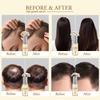 Biotin, Castor & Rosemary Oil for Hair Growth for Women, hair loss treatments for dry damaged hair and growth, Serum for Thicker Longer Fuller Healthier Hair, All Natural Vitamin Rich Treatment view 2