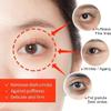 Peehss Anti-Wrinkle Magic Eye Cream, Collagen Boost Anti-Aging Serum Rapid Reduction Eye Cream, Instantly Reduces Wrinkles, Under-Eye Bags, Dark Circles (2Bottles) view 3