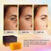 VALITIC Kojic Acid Dark Spot Remover Soap Bar with Vitamin C,Retinol,Collagen,Turmeric - Original Japanese Complex Hyaluronic Acid,E,Shea Butter,Castile Oil (2 Pack) With Holder,Pack of 3,3.5 ounces view 2